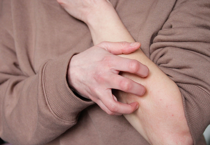 Photo shows a woman experiencing intense itching