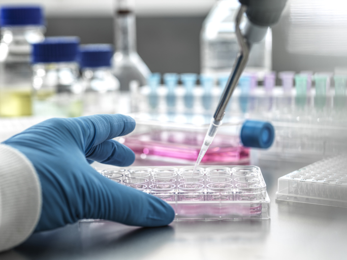 Photo shows a scientist pipetting medical samples into microplate in laboratory/Getty Images